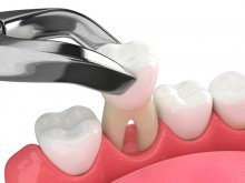 ������� ����� ��� ����� ��������