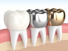 ������� ������ � �������������� �����: �� � ������������� ��������