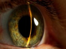 ����������� ������ ������� ��������: �� ������ �� ��������