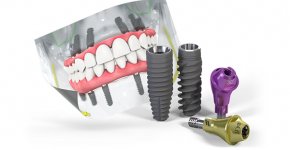 �������� Straumann: ����������� �������� ��� ����� ������