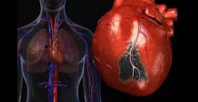 Диагностика болезней сердца