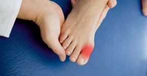 Как снять воспаление сустава большого пальца ноги?