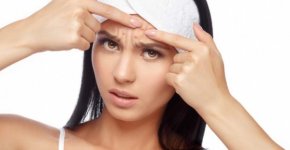Прыщи на лице: причины появления и эффективные методы лечения