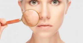 Причины развития и методы лечения дерматитов на лице