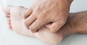 Особенности проявления и лечения экзематозного дерматита на руках и ногах
