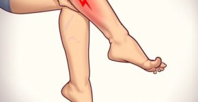 Varicose veins or just dilated veins: How to tell the difference?