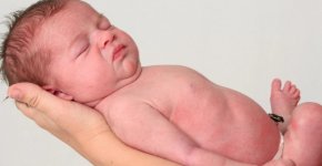 Почему у новорожденных возникает эритема и нужно ли ее лечить?