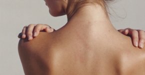 Прыщи на плечах: почему появляются и как лечить?