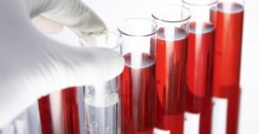 Анализ крови на сифилис: когда назначается, как и где сдается