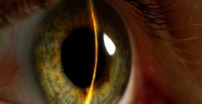 ����������� ������ ������� ��������: �� ������ �� ��������