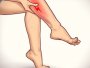 Varicose veins or just dilated veins: How to tell the difference?