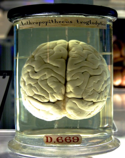 Мозг человеческий