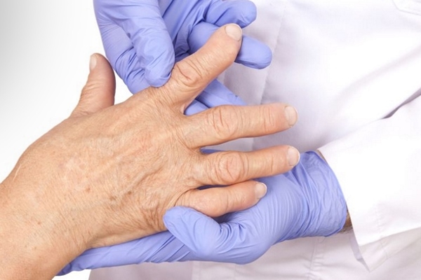 Деформирующий артрит пальцев рук