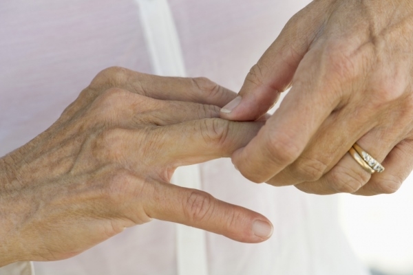 Симптомы артрита кистей и пальцев рук