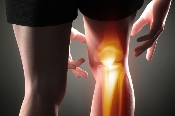 Развитие артрита коленных суставов
