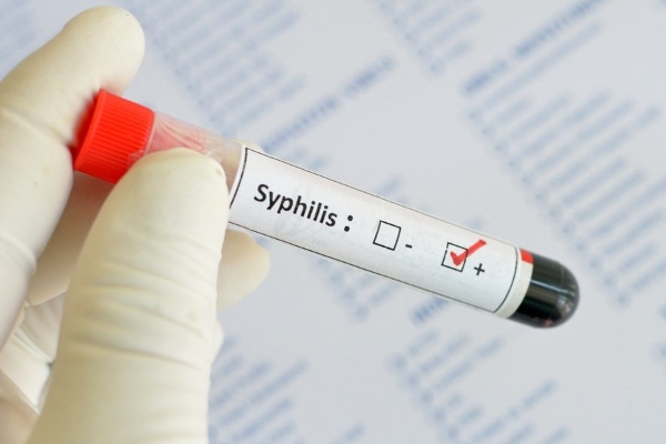Диагностика сифилиса